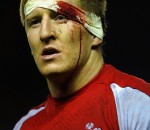 Bradley Davies
