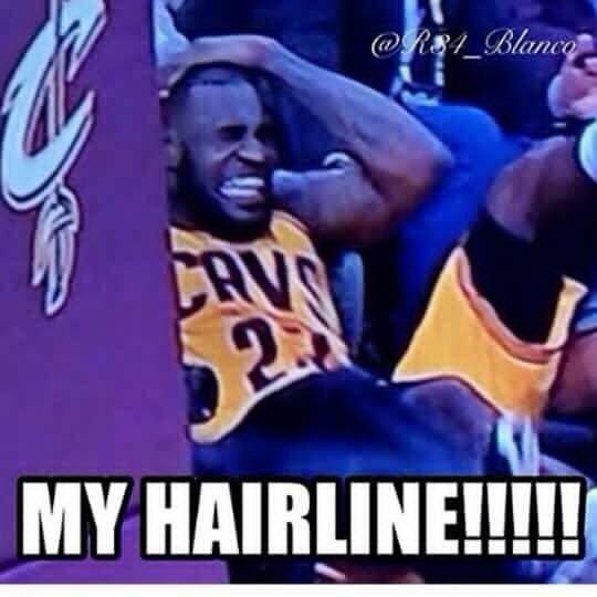 My Hairline