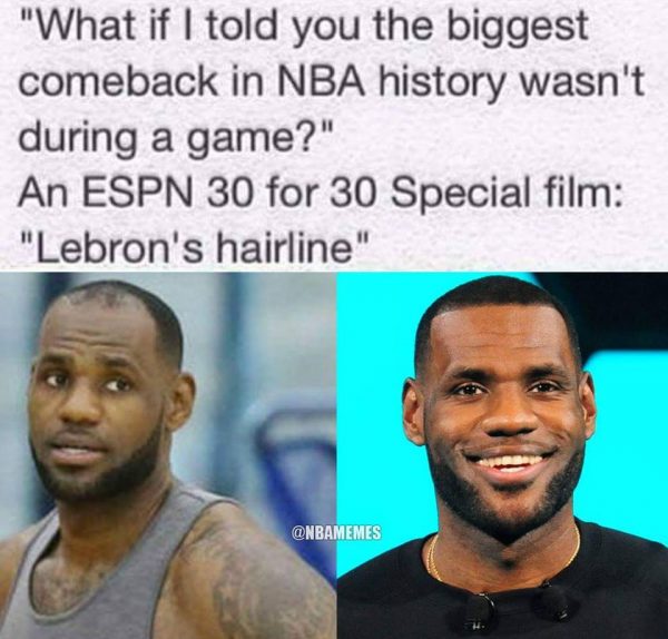 LeBron James Hairline Meme