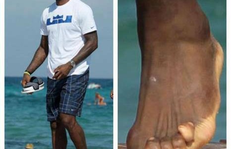 LeBron James Secret to Success – Freakish Looking Foot