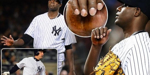 Yankees Over Red Sox – Michael Pineda and the Mystery Substance